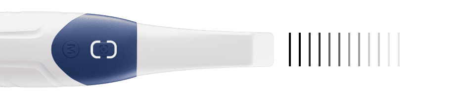 prikaz hitrosti skeniranja intraoralnega skenerja alliedstar as 200e